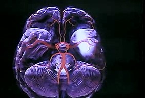 생로병사의 비밀[KBS]2.jpg